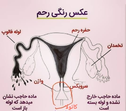 blog img